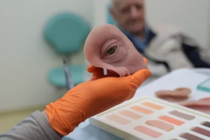 Ambulatório de próteses faciais reconstrutivas do Hospital de Reabilitação do Paraná