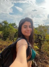 Conheça a história dramática de Juliane, que sofreu queimaduras em 77% do corpo em um incêndio em Cascavel - Foto: Reprodução/Redes Sociais 