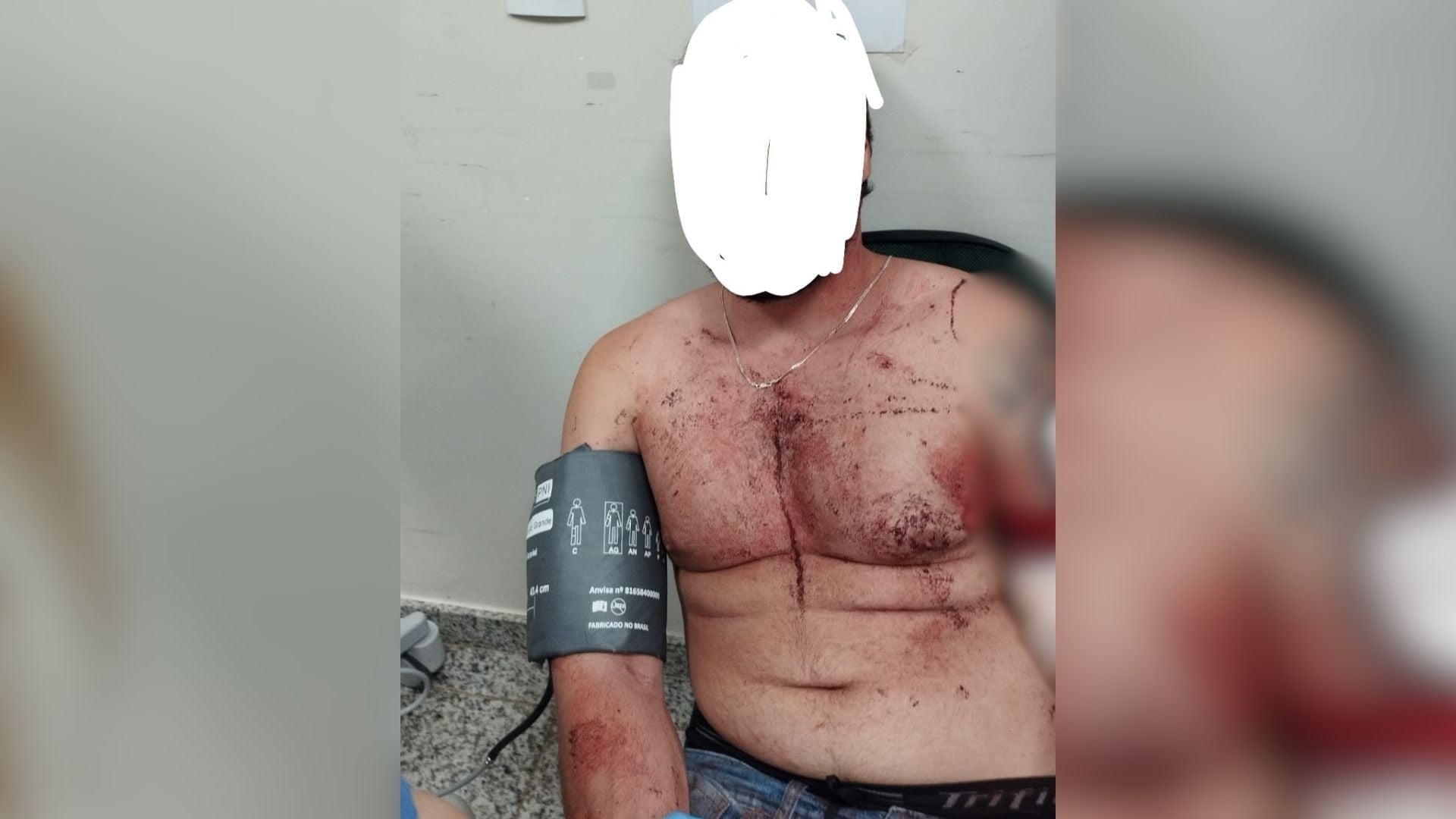 Homem é esfaqueado após confusão na casa da ex-companheira em Cascavel